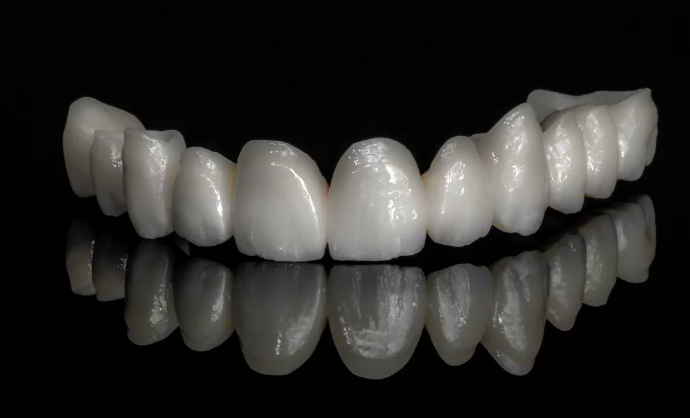 Crown and bridge restorations