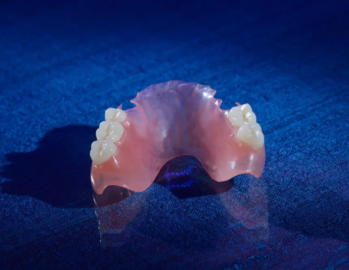 Valplast and TCS flexible partial dentures