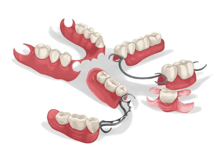 Partial denture service